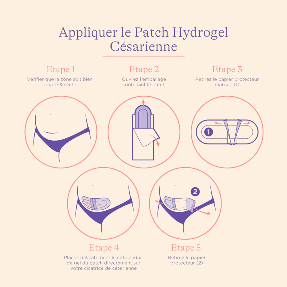 Patch Hydrogel pour Césarienne